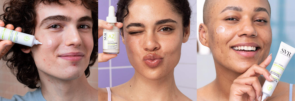 Acne Is More Than Just Oily Skin