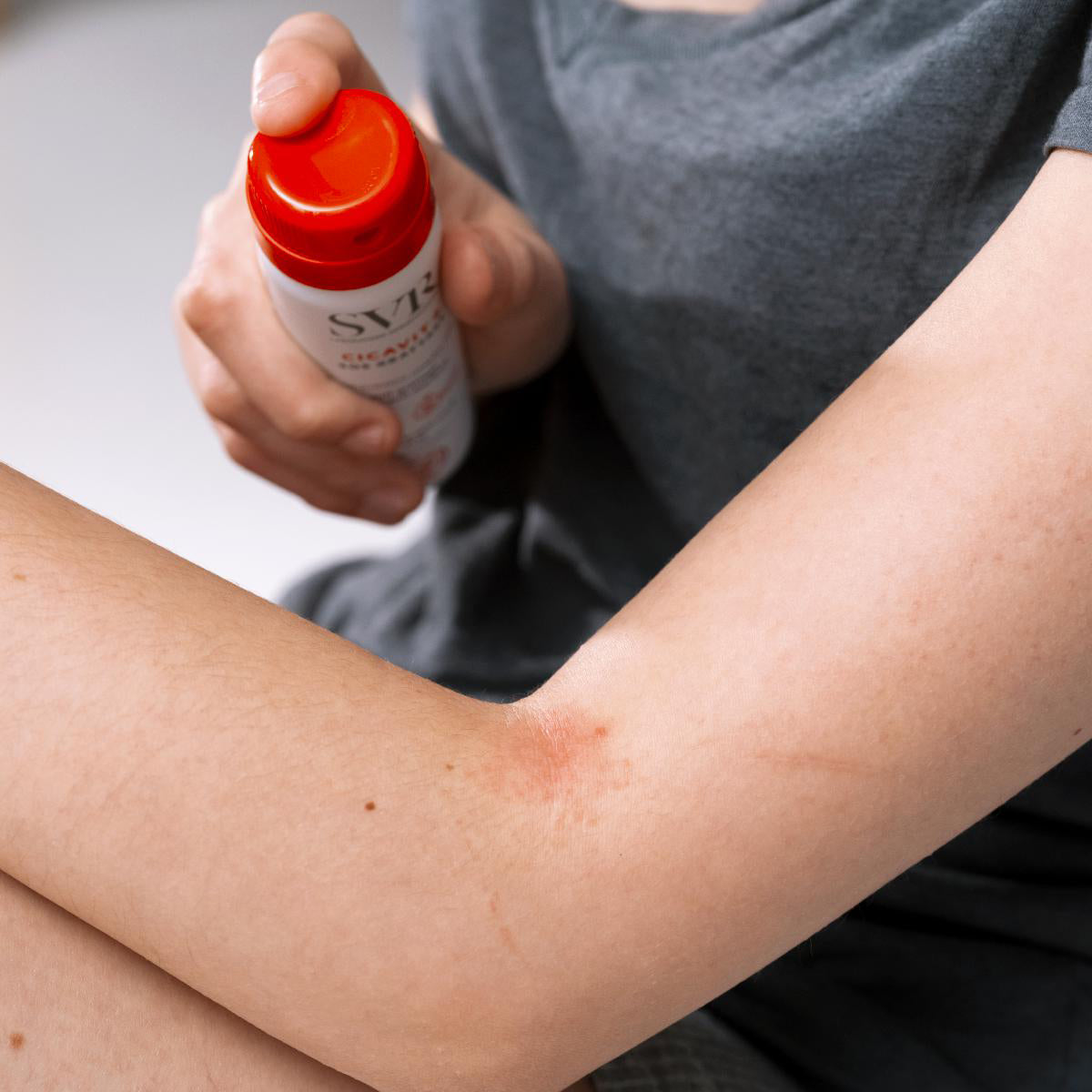 CICAVIT+ SOS Anti-Itch Spray
