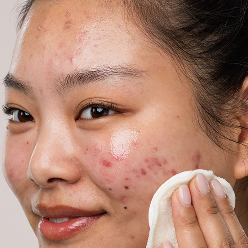 SEBIACLEAR Micellar Water