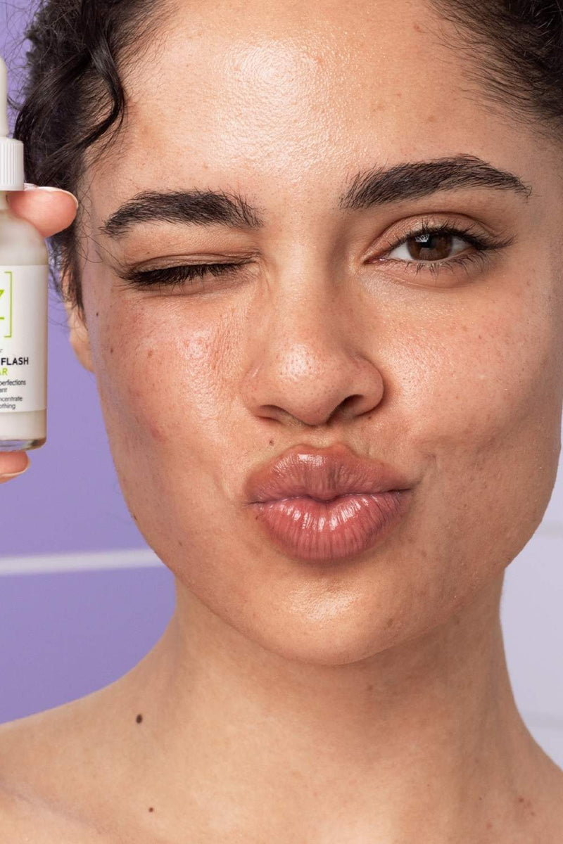 Acne Is More Than Just Oily Skin