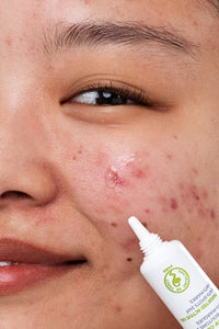 SVR Sebiaclear acne skincare range